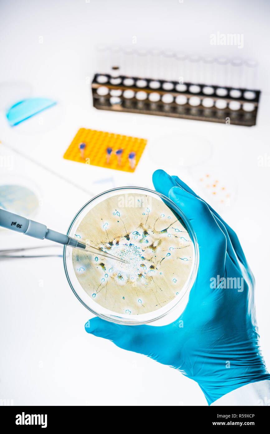Neurone in a petri dish illustrating research into Alzheimer's and