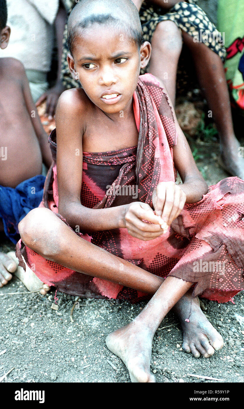 1992 - A Somali child waits for her allotment of food at a food delivery site set up during Operation Restore Hope relief efforts. (Baidoa Somalia) Stock Photo