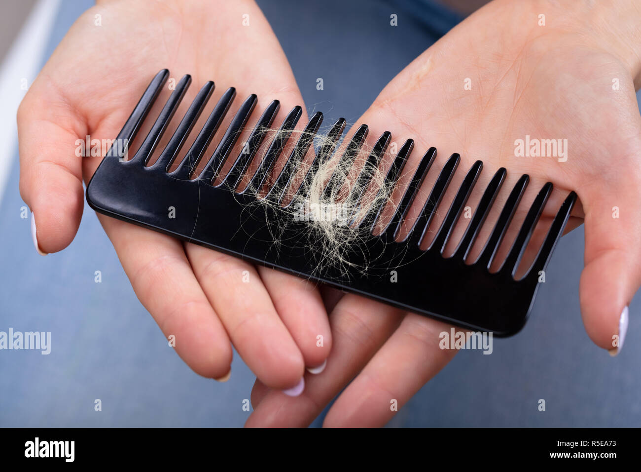 Close-up Of A Woman's Hand Holding Comb With Hair Loss Stock Photo