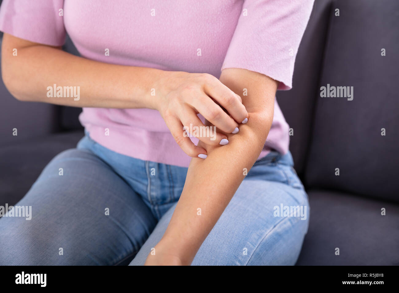 Close-up Of A Woman's Hand Scratching The Itch On Her Arm Stock Photo