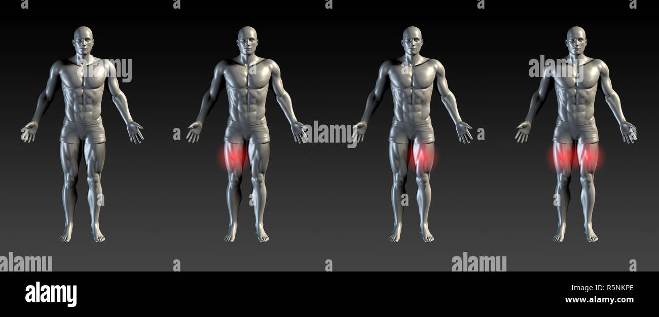 Muscles of the thigh hires stock photography and images Alamy