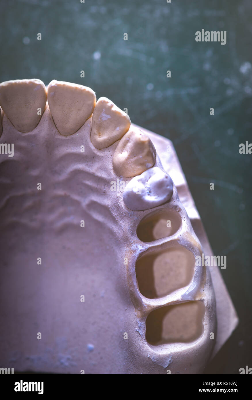 Dental Prosthesis Prosthetic Laboratory Stock Photo Alamy