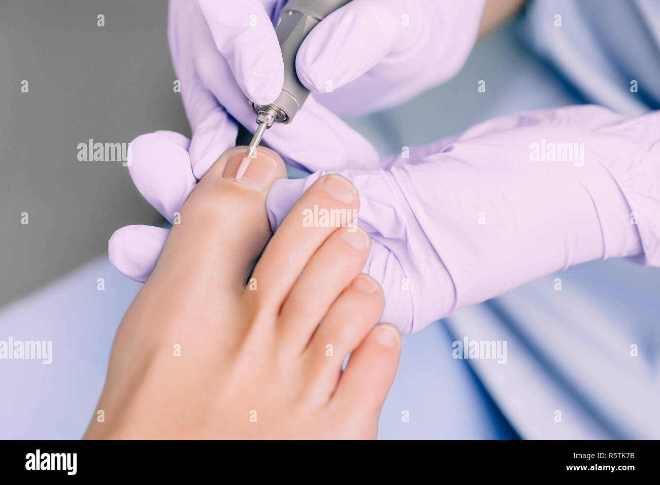 Chiropodist treating a patient's foot, pedicure treatment Stock Photo