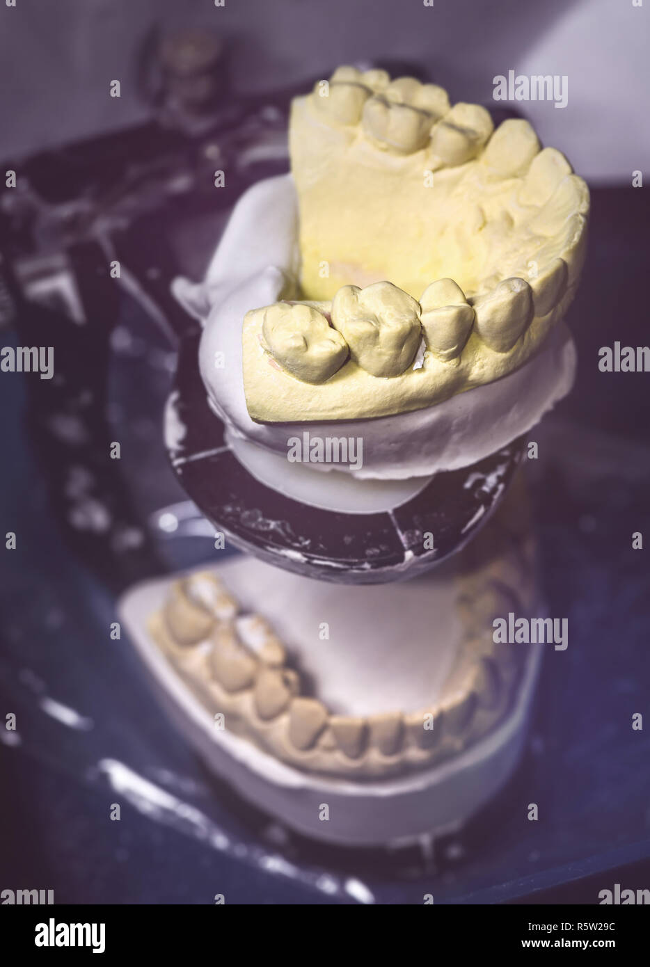 Dental Prosthesis Prosthetic Laboratory Stock Photo Alamy