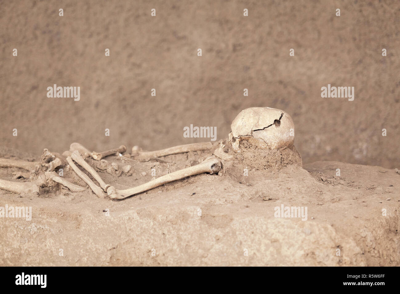 Skeleton. Trepanned skull. Stock Photo