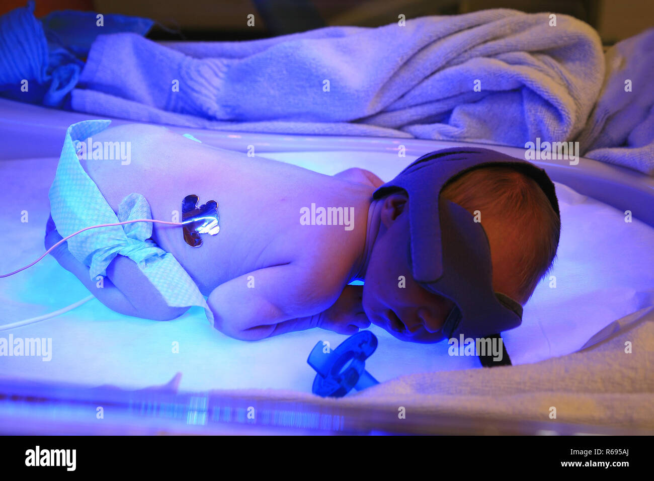 Baby with phototherapy hires stock photography and images Alamy