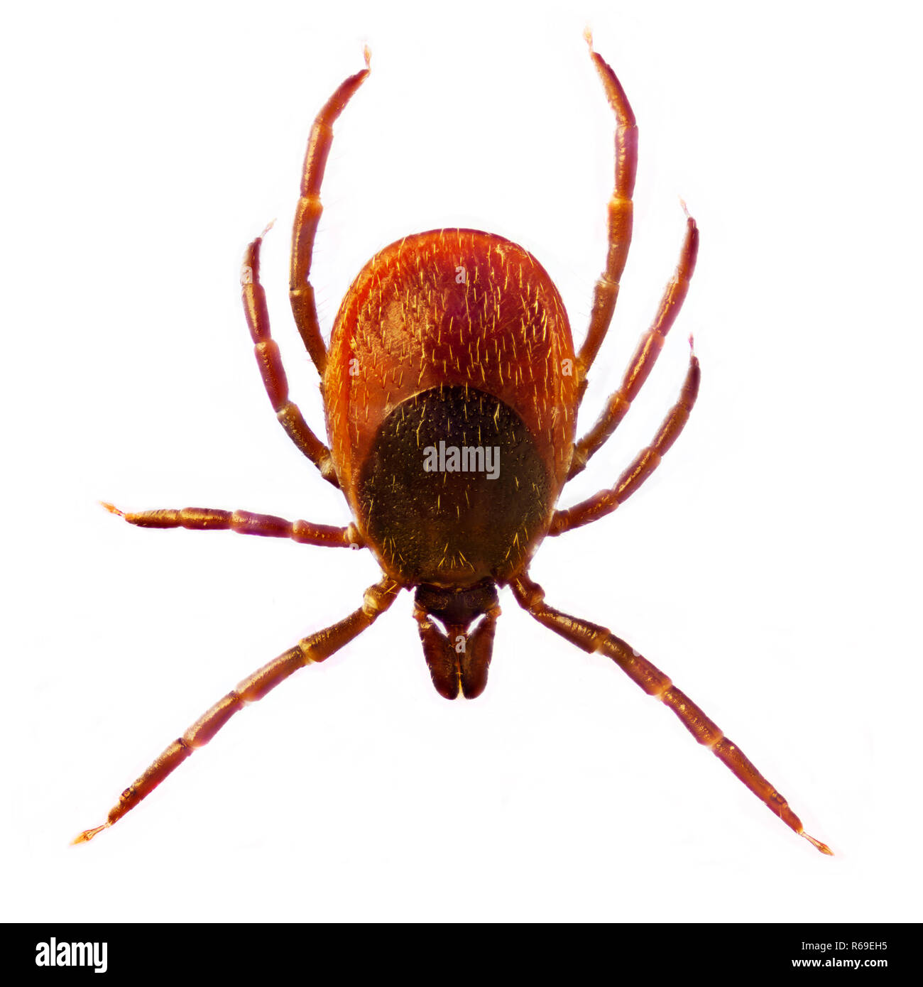 Microphoto Of A Tick Ixodes Ricinus Stock Photo