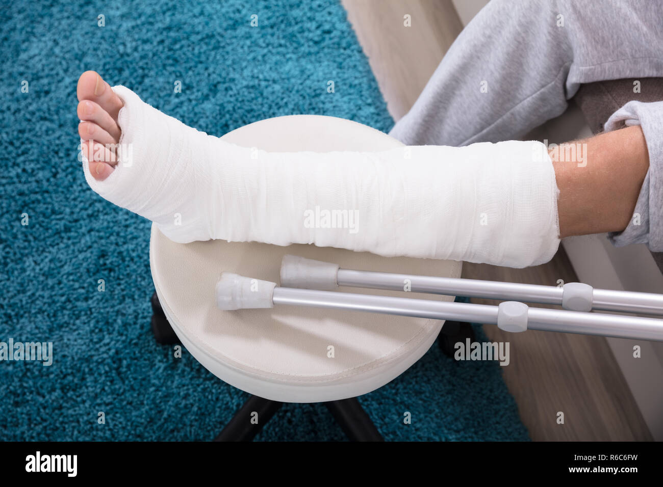 Man's Broken Leg Stock Photo Alamy