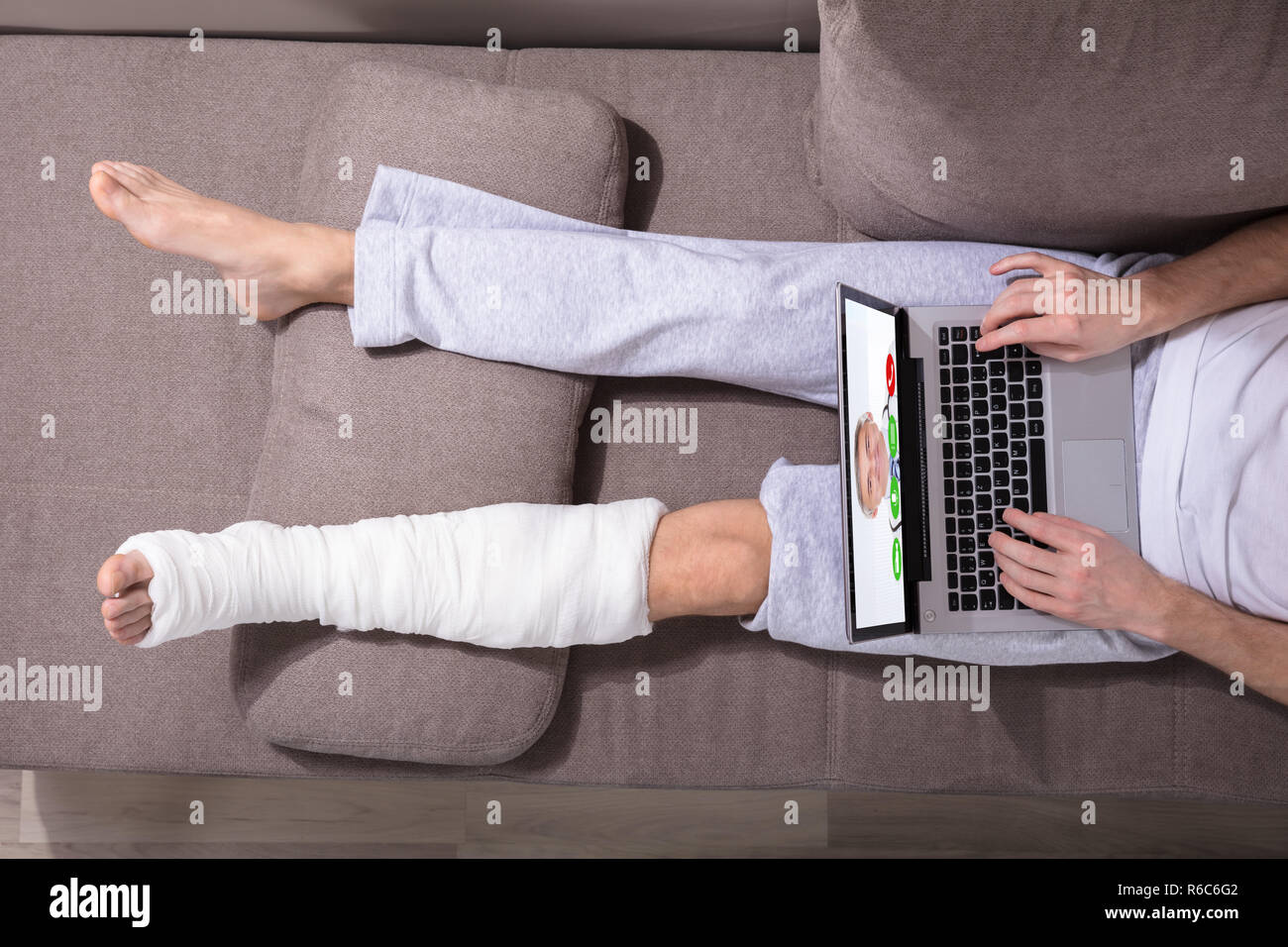 Man With Plastered Leg Using Laptop Stock Photo
