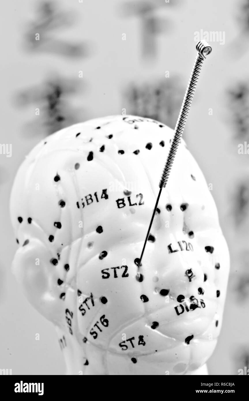 Acupuncture Needle On Head Model Stock Photo Alamy