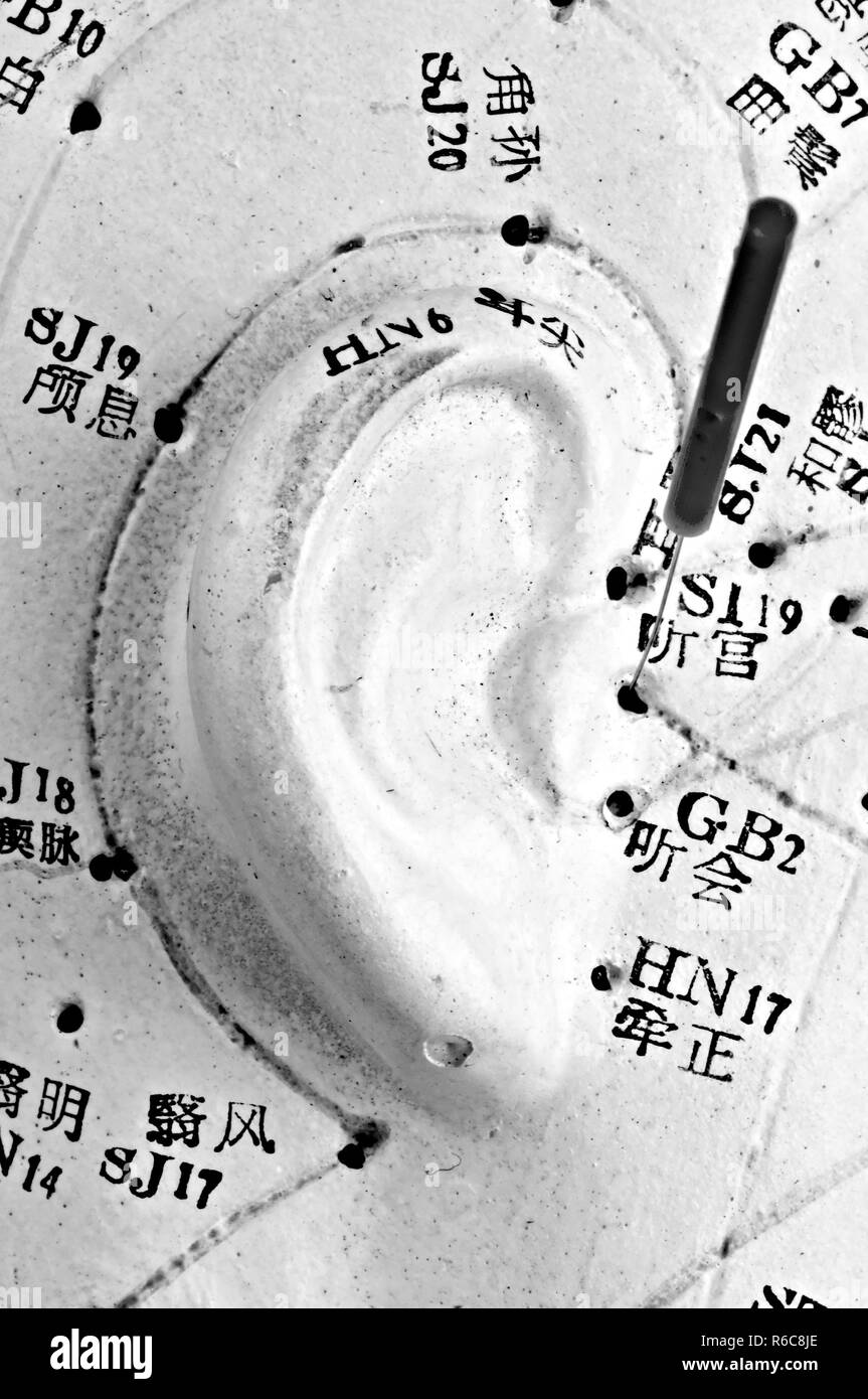 Acupuncture Needle On Ear Model Stock Photo Alamy