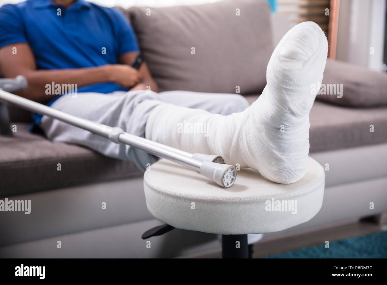 Broken Leg Bed High Resolution Stock Photography and Images Alamy