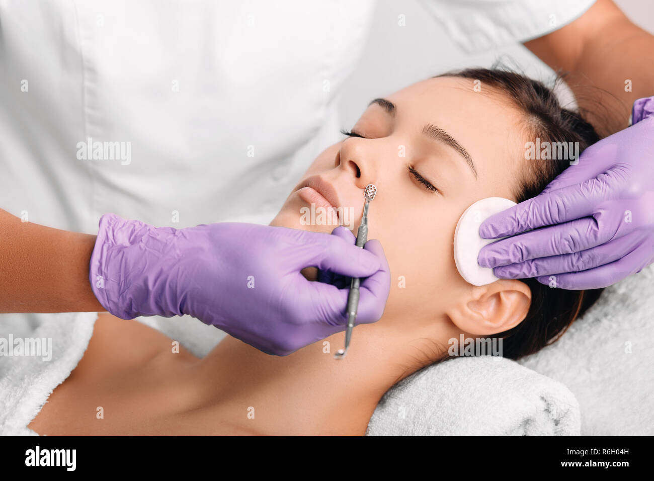 woman have mechanical facial cleansing, procedure for cleansing pores and skin from defects Stock Photo