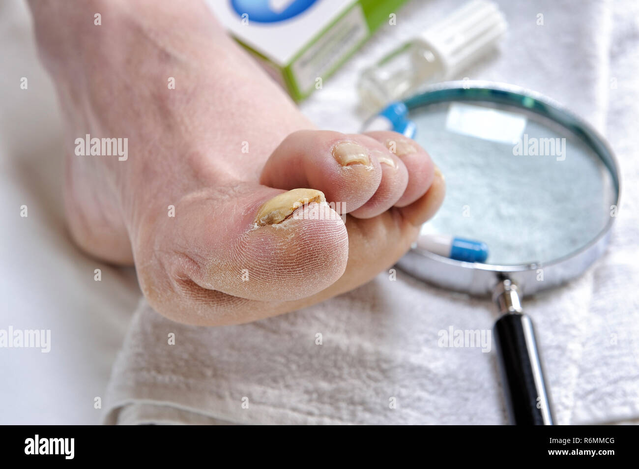 Onychomycosis medication hires stock photography and images Alamy