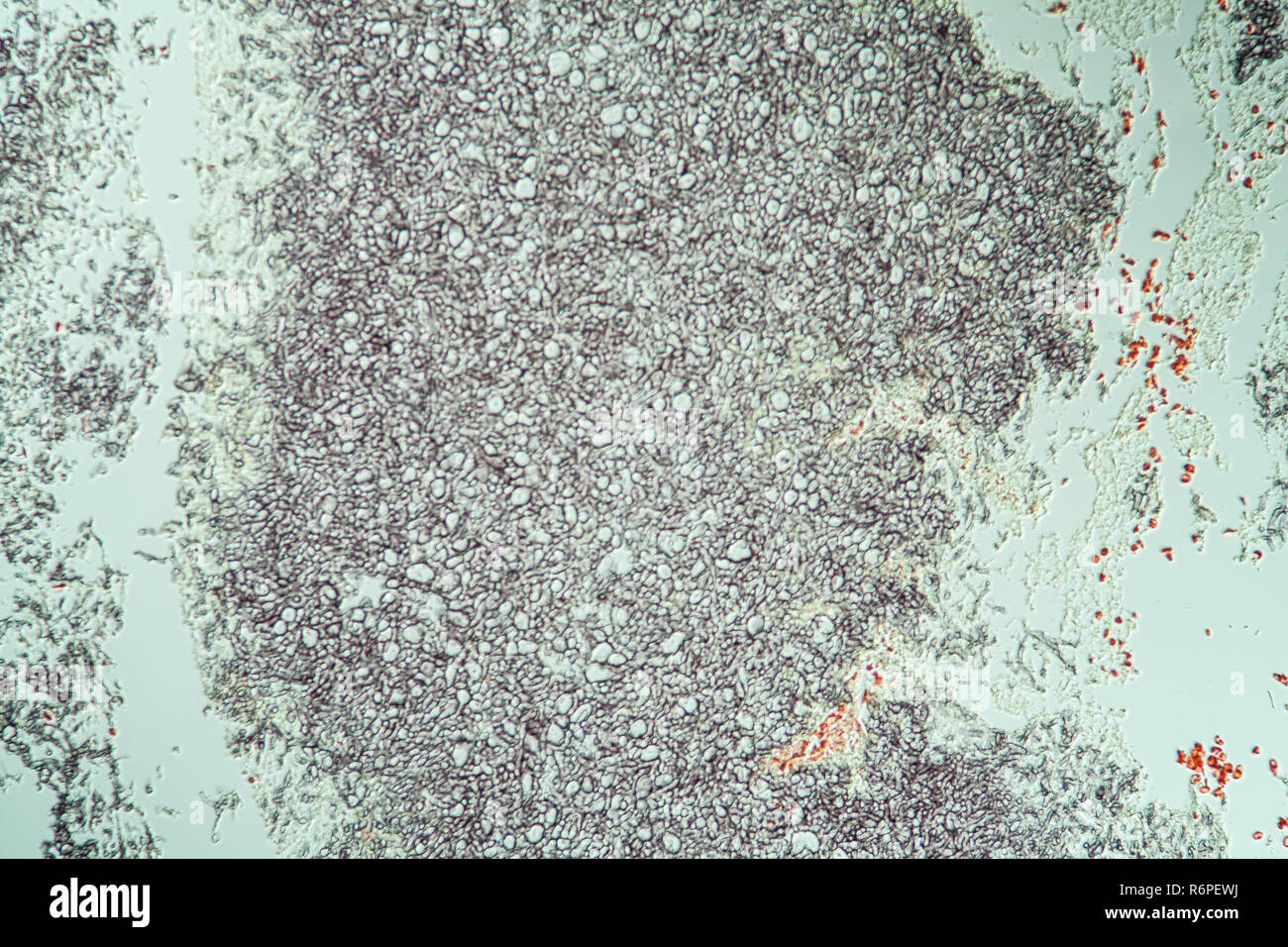 Pathogenic fungi hi-res stock photography and images - Alamy