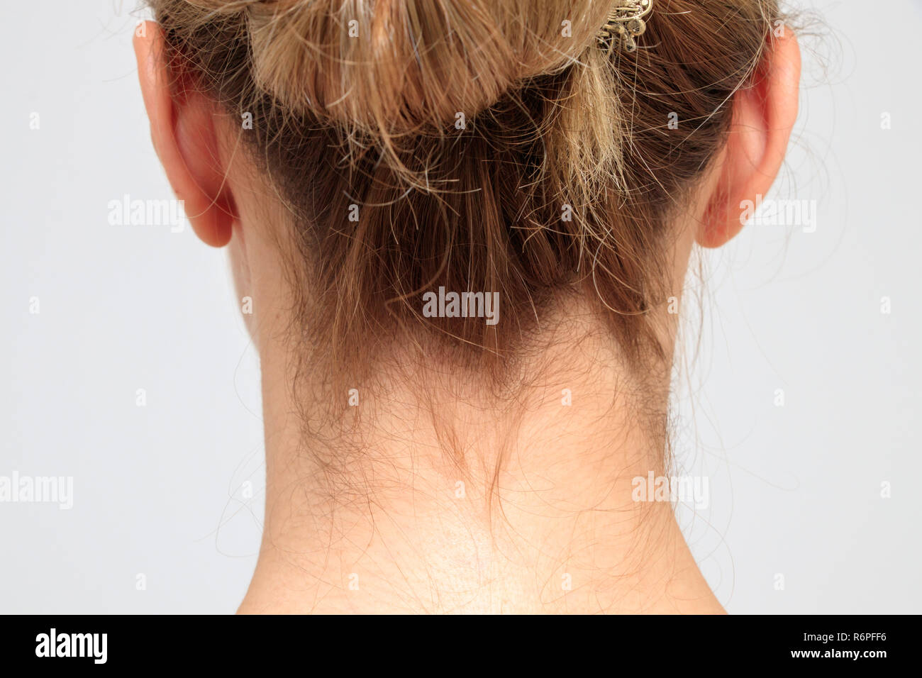 Nape Of A Young Woman S Neck Stock Photo Alamy