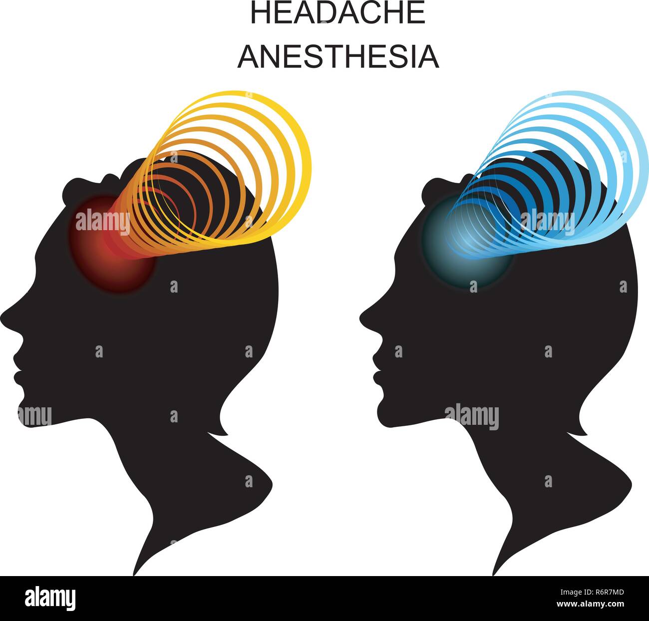 illustration of headache in women. migraine Stock Vector