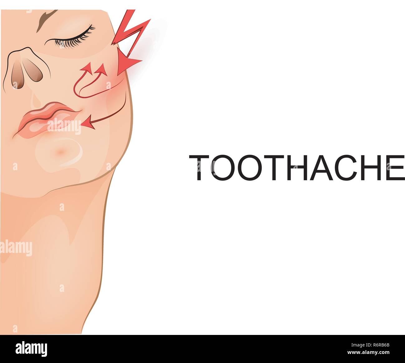 vector illustration of a toothache at the girl  Stock Vector