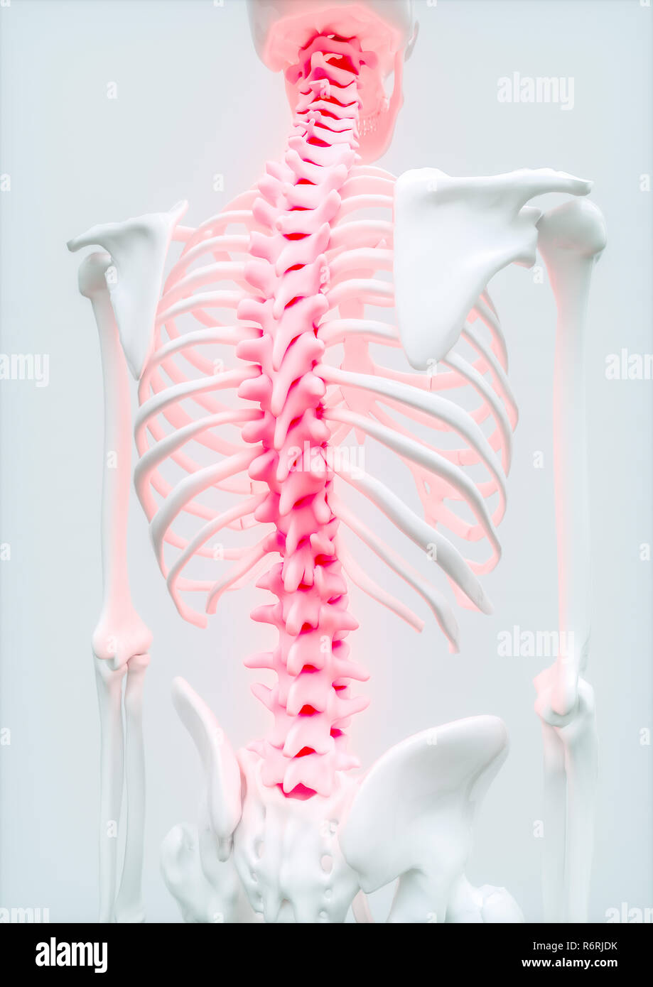 Aching Spine - upper limb bone - 3d rendering Stock Photo