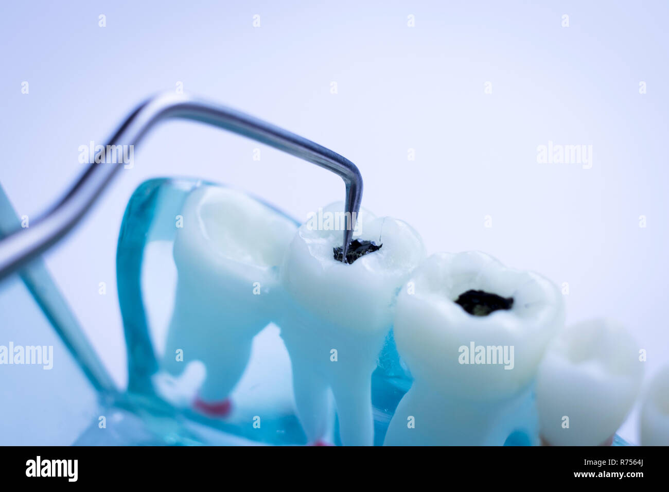 Dentist cleaning teeth with titanium metal tooth pick instrument to