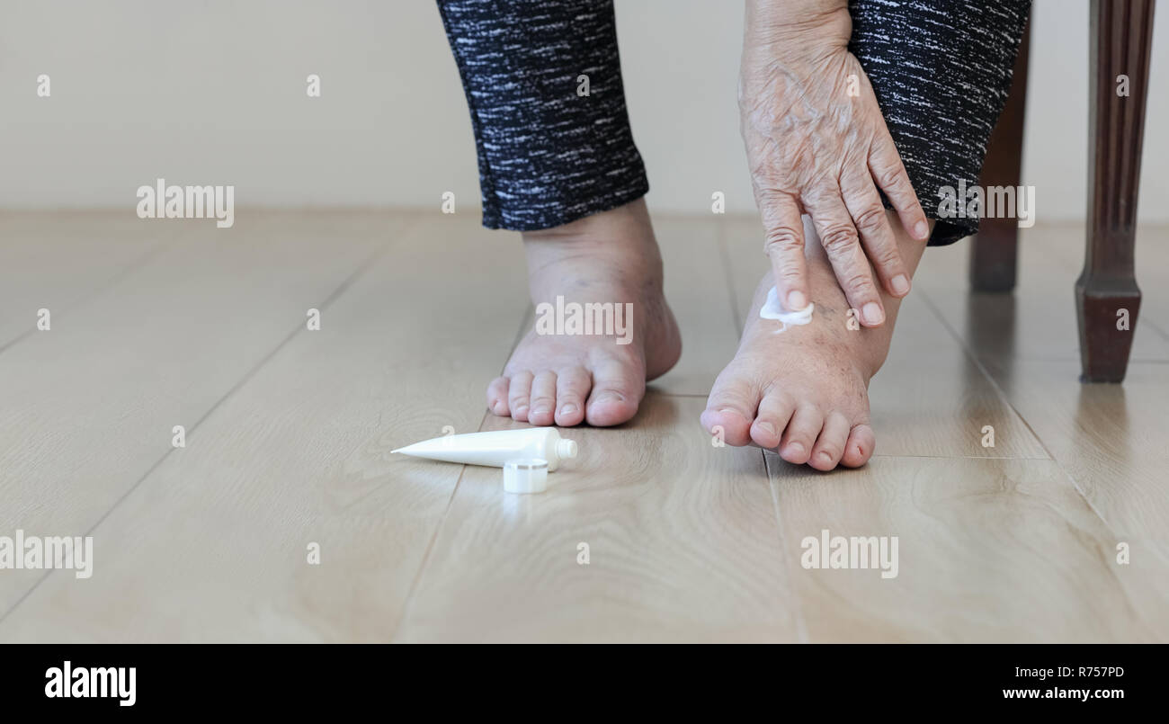 Elderly woman putting cream on swollen feet Stock Photo