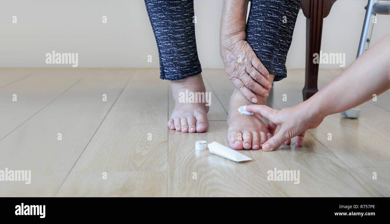 Elderly woman putting cream on swollen feet Stock Photo