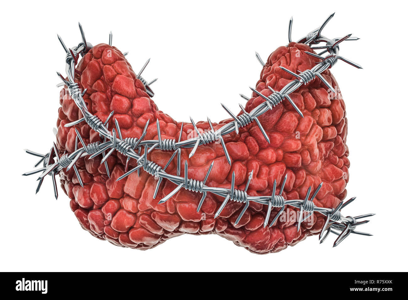 Human thyroid with barbed wire. Thyroid disease concept. 3D rendering