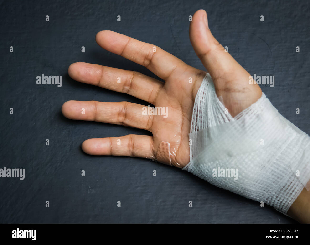 dressing hand pic