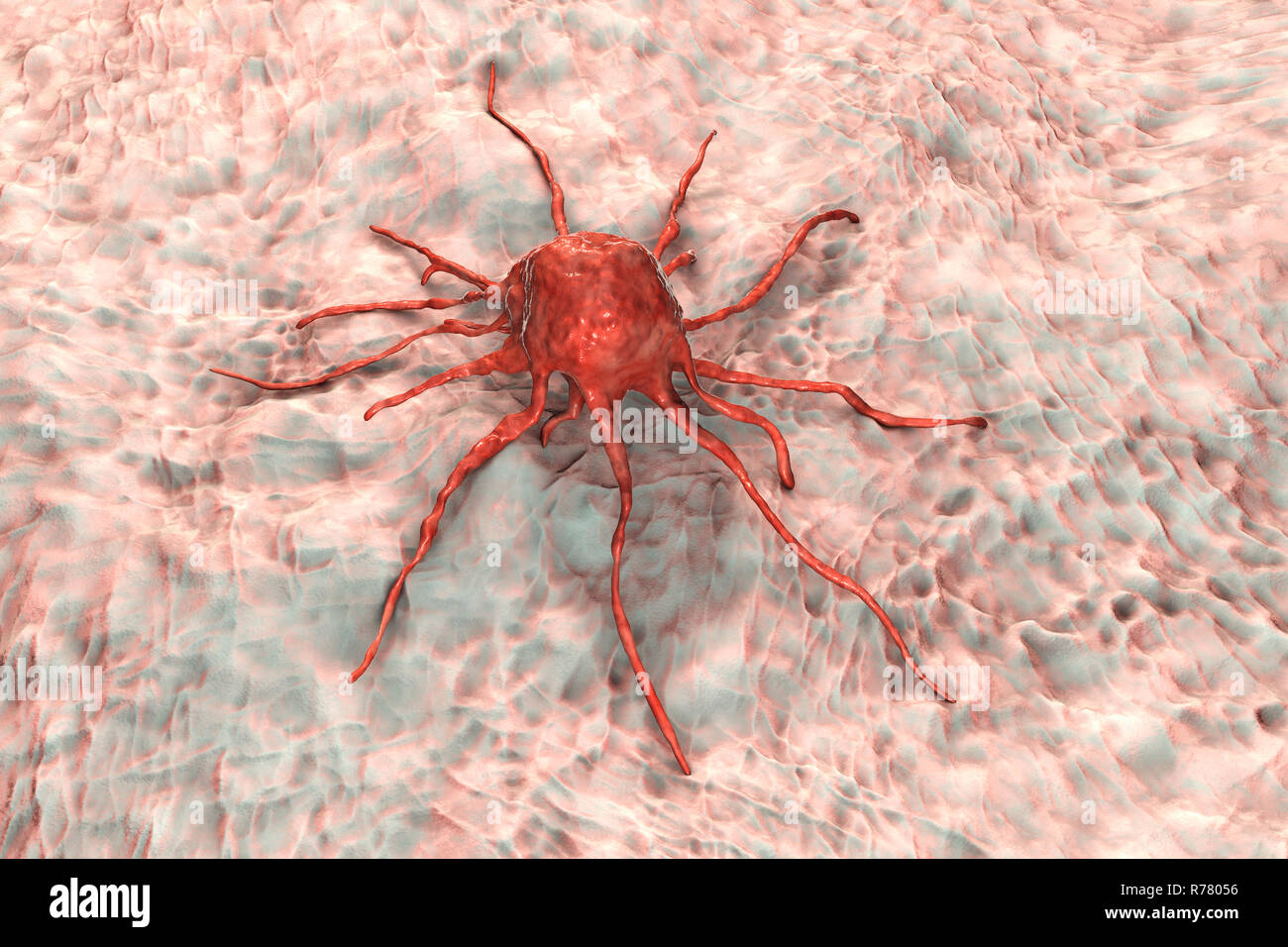 Cancer cell, computer illustration Stock Photo - Alamy