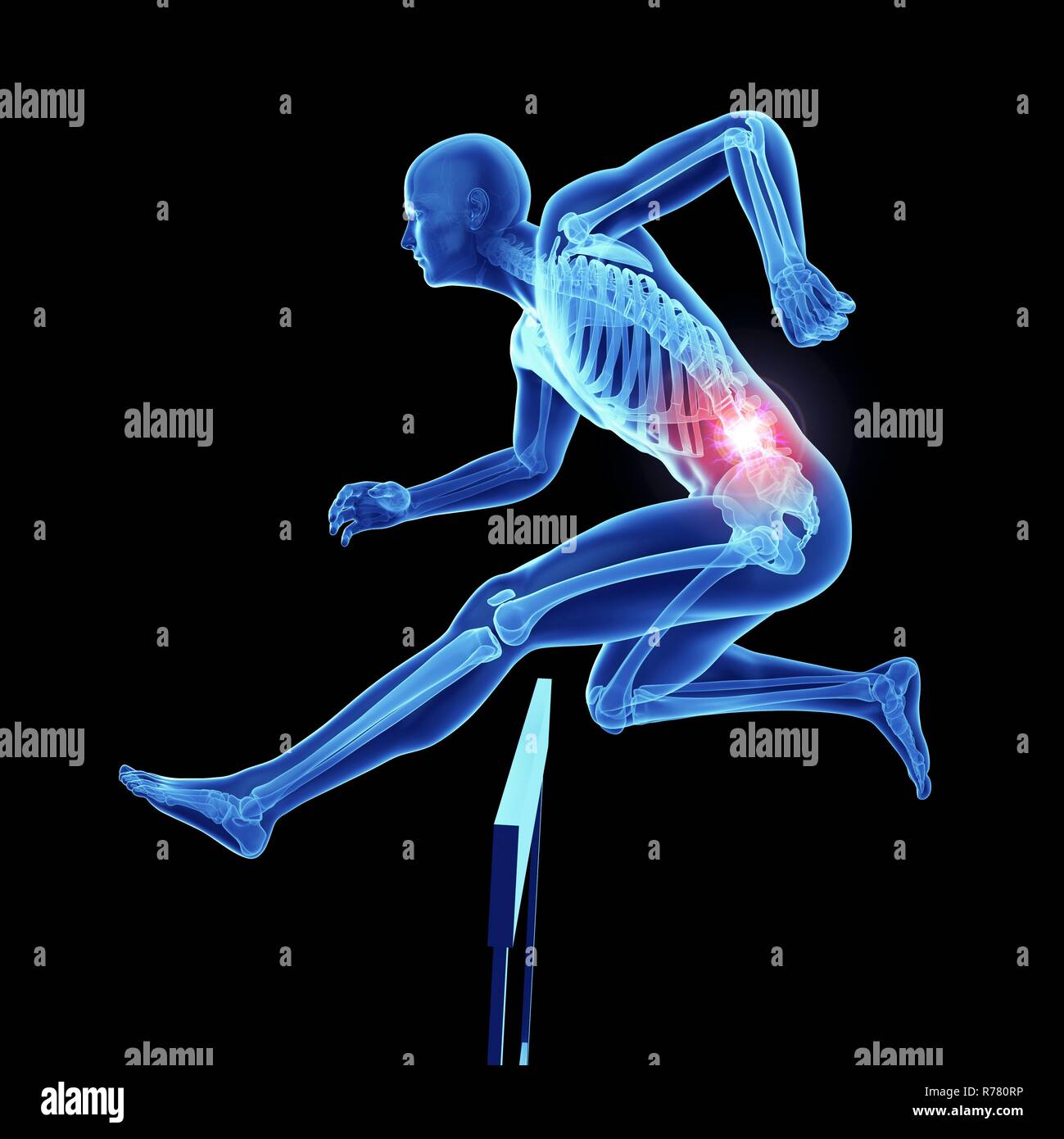 Gout gout athlete hires stock photography and images Alamy
