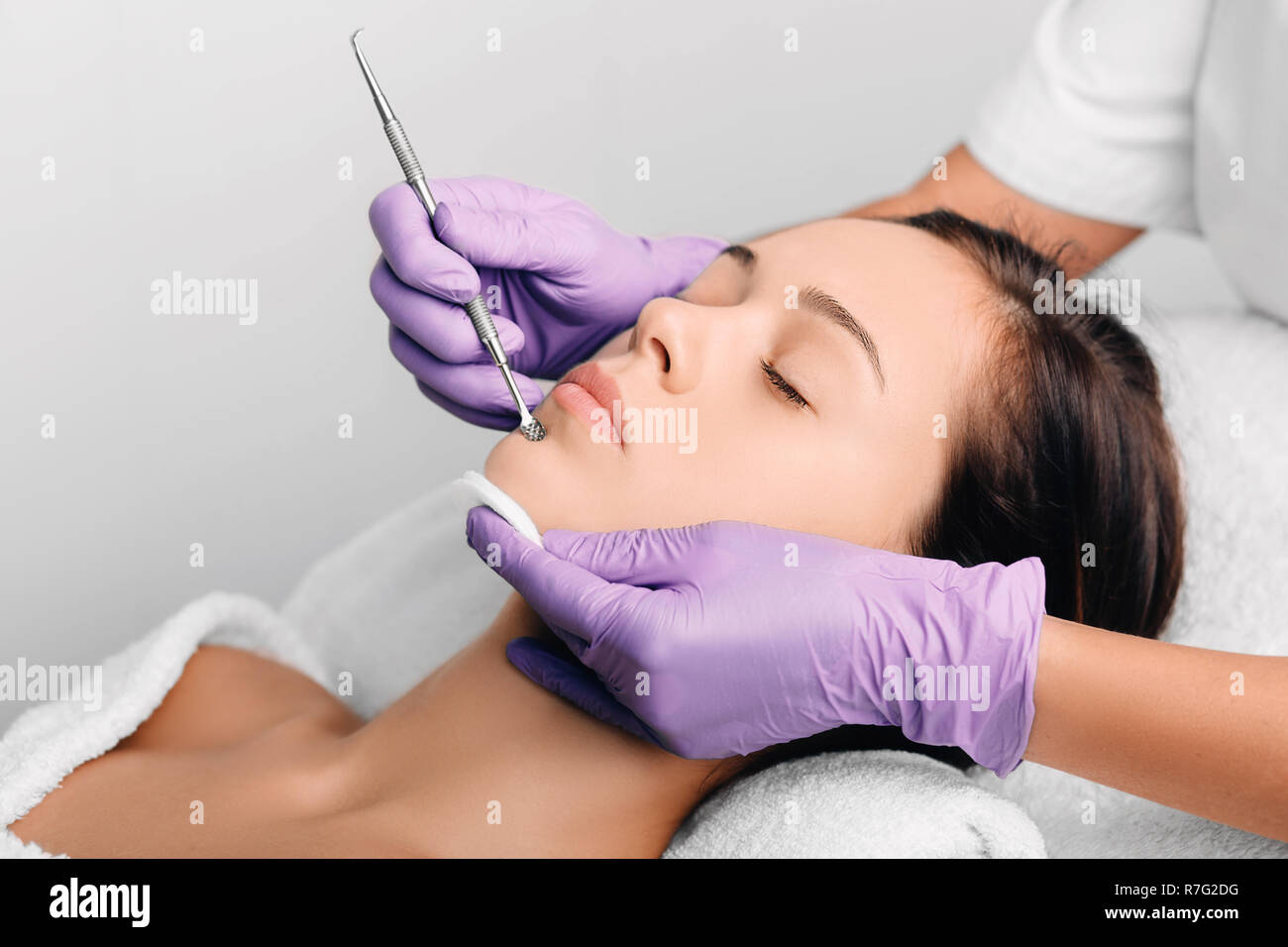 Beautiful woman having mechanical facial cleansing, remove blackhead Stock Photo