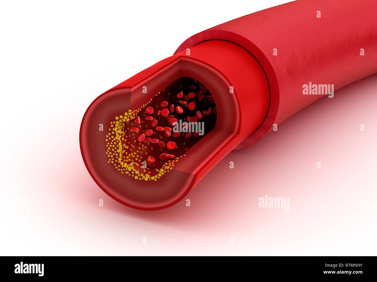 Blood vessel sliced macro with erythrocytes , Medically accurate 3D illustration Stock Photo