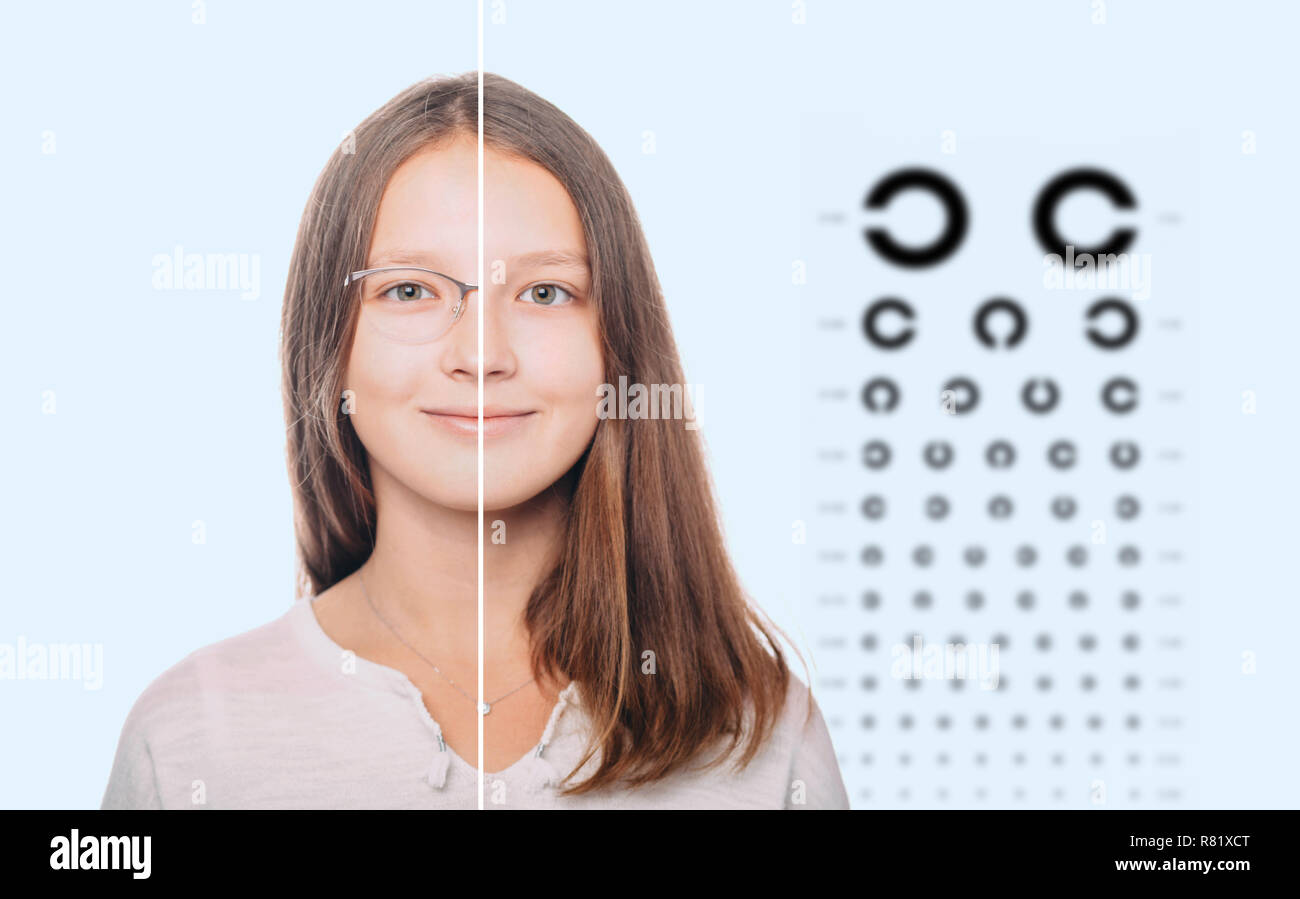 comparison girl with eyeglasses and with contact lenses Stock Photo