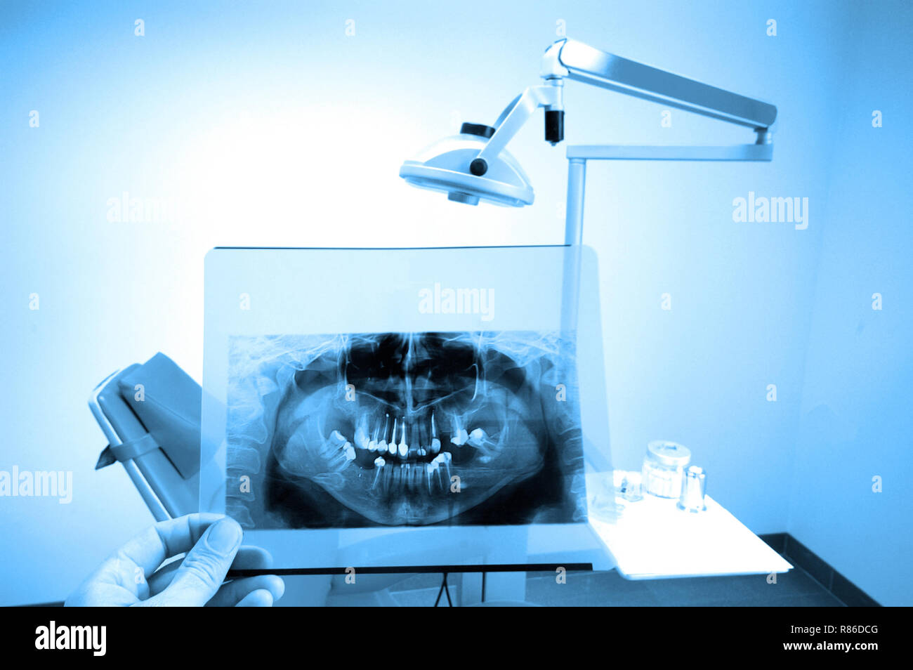 photo of full mouth dental xray(xray), blue tone Stock Photo Alamy