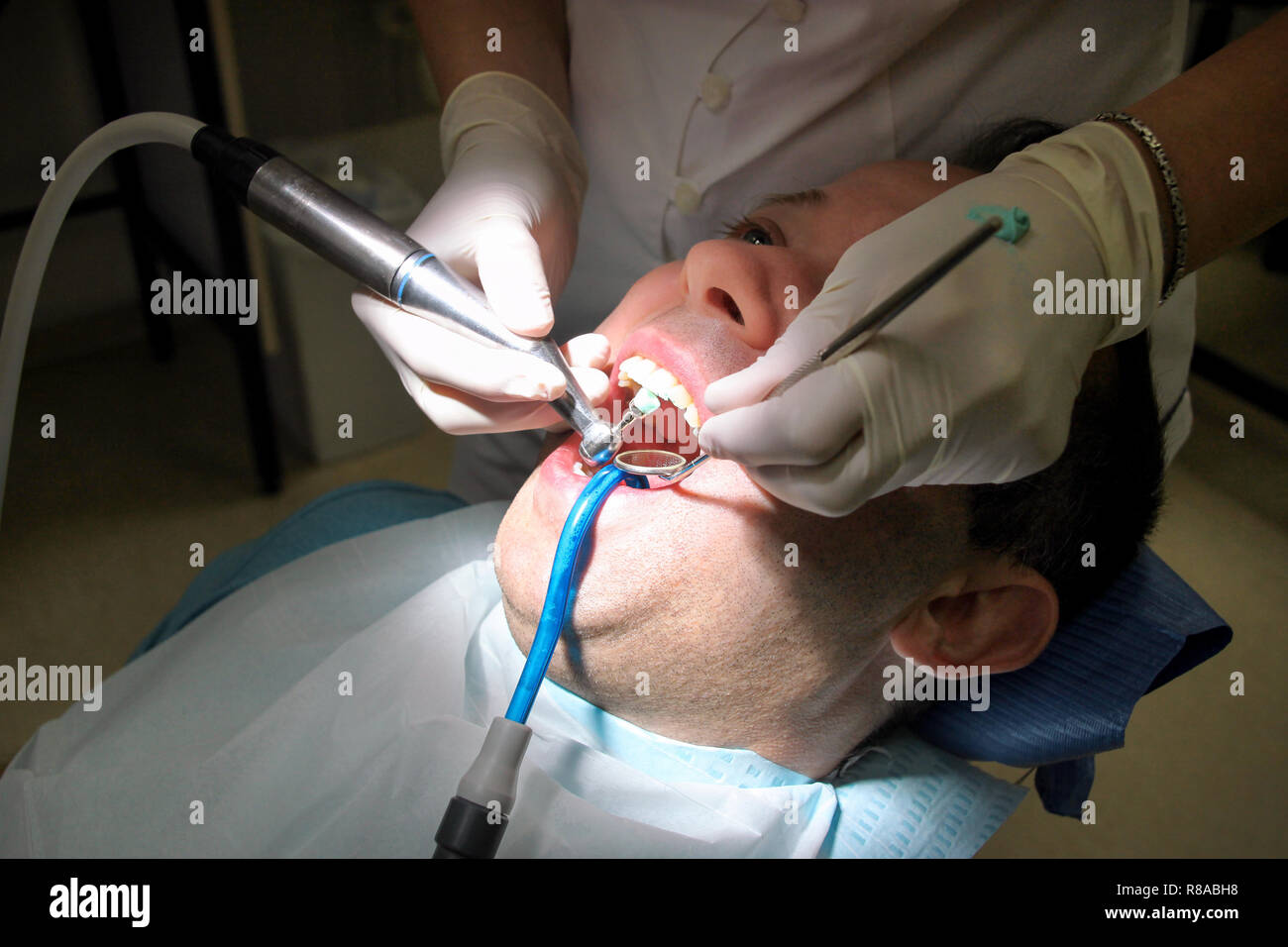 Dental tooth polishing. Teeth cleaning, dental hygiene. Dentist at work