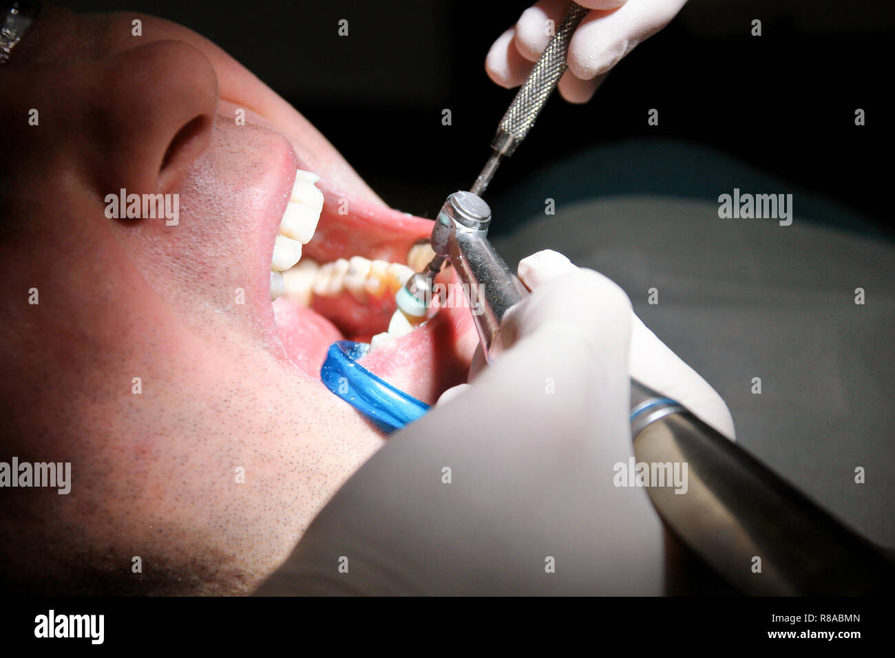 Dental tooth polishing. Teeth cleaning, dental hygiene. Dentist at work in his dentist clinic