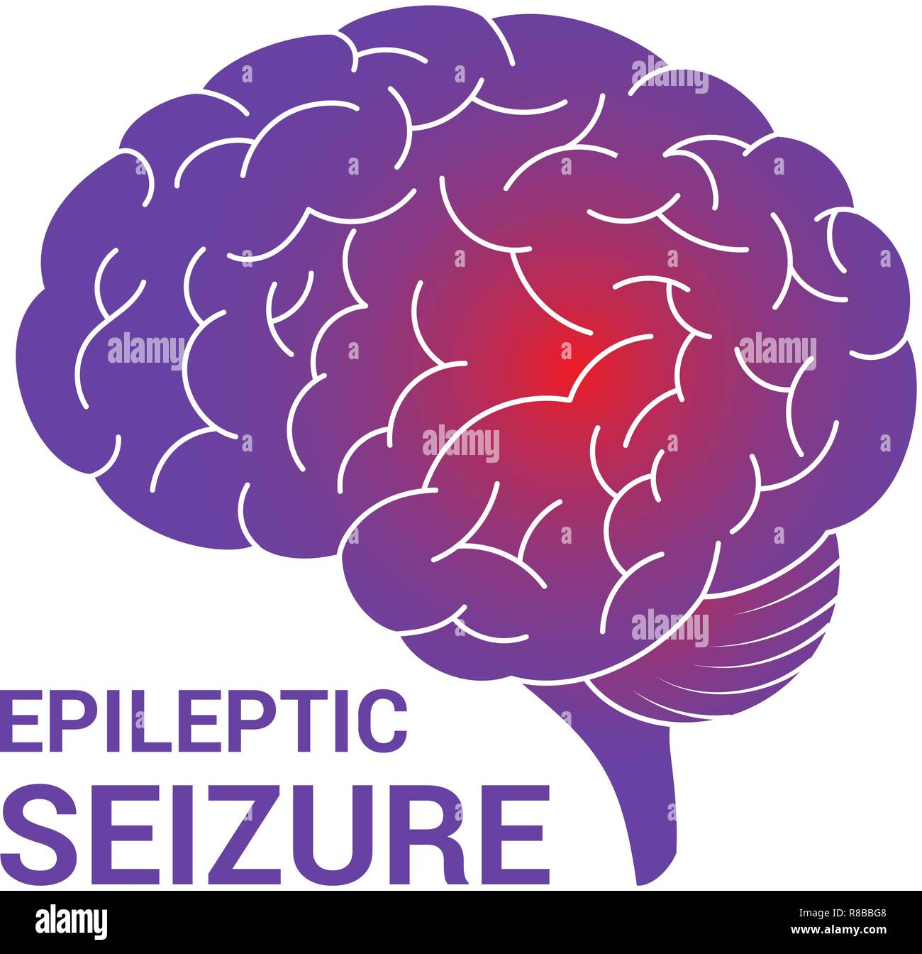 Seizure brain Stock Vector Images - Alamy