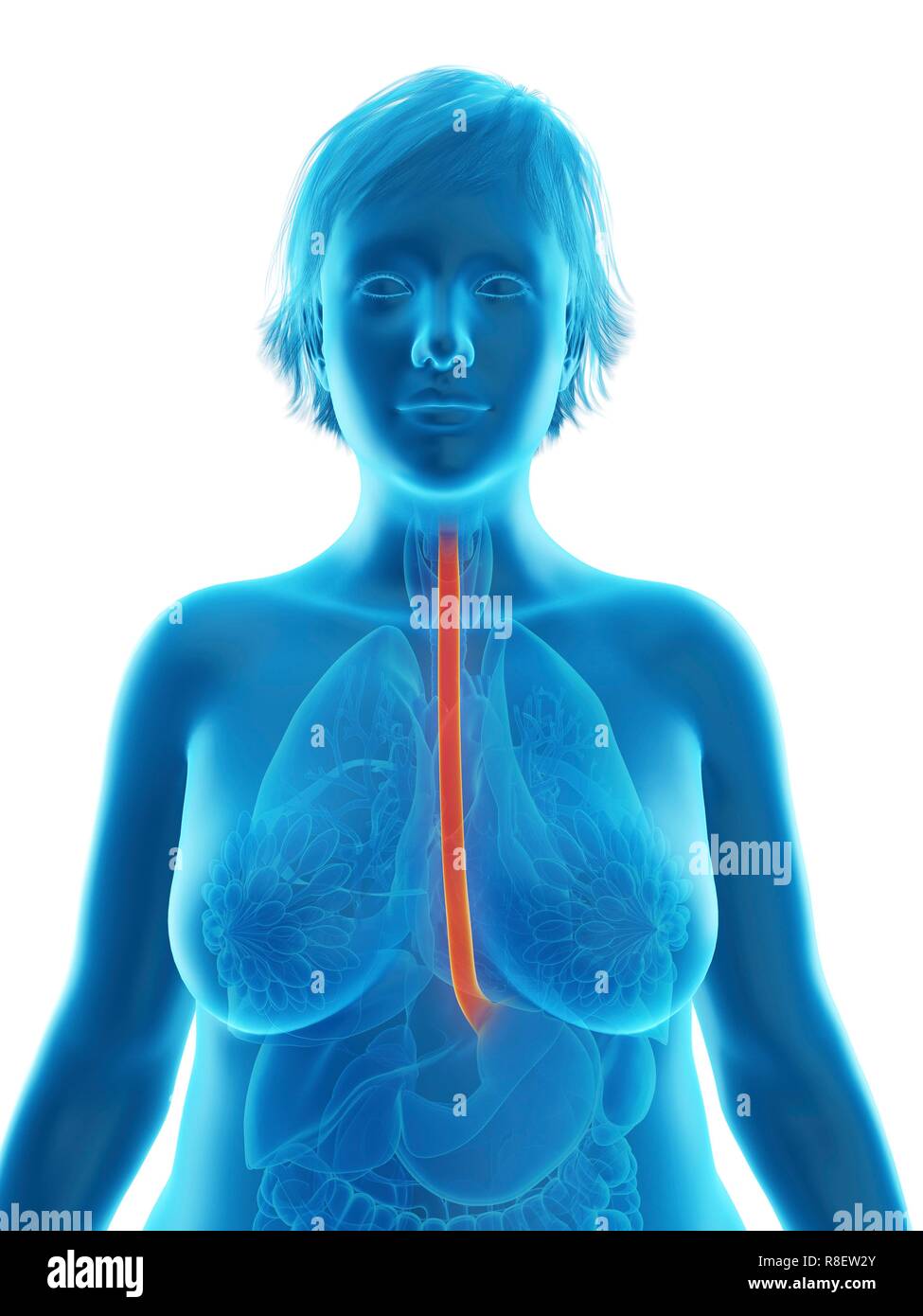 Illustration of an obese woman's esophagus. Stock Photo