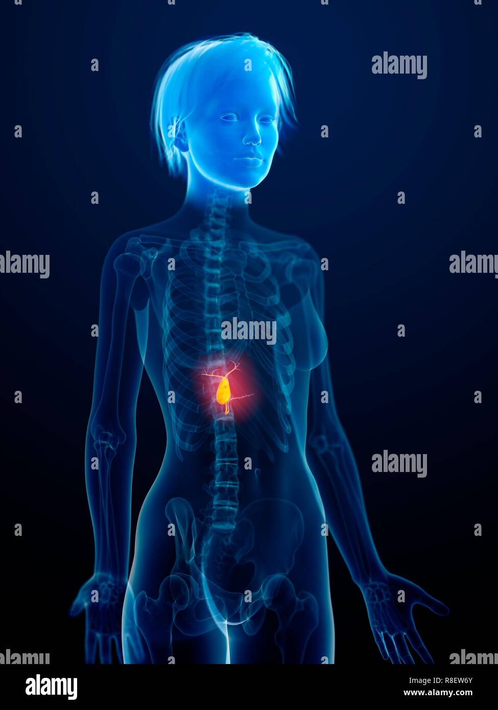 Illustration of an inflamed gallbladder. Stock Photo
