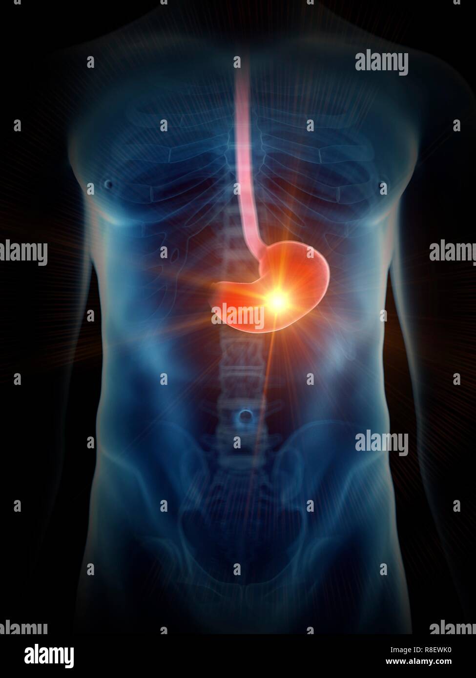 Illustration of a painful stomach. Stock Photo