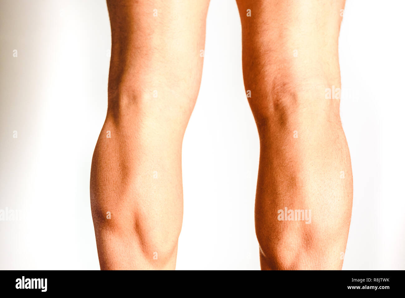 Muscles of the posterior leg, soleus and gastrocnemius muscle, photo of an athlete. Stock Photo