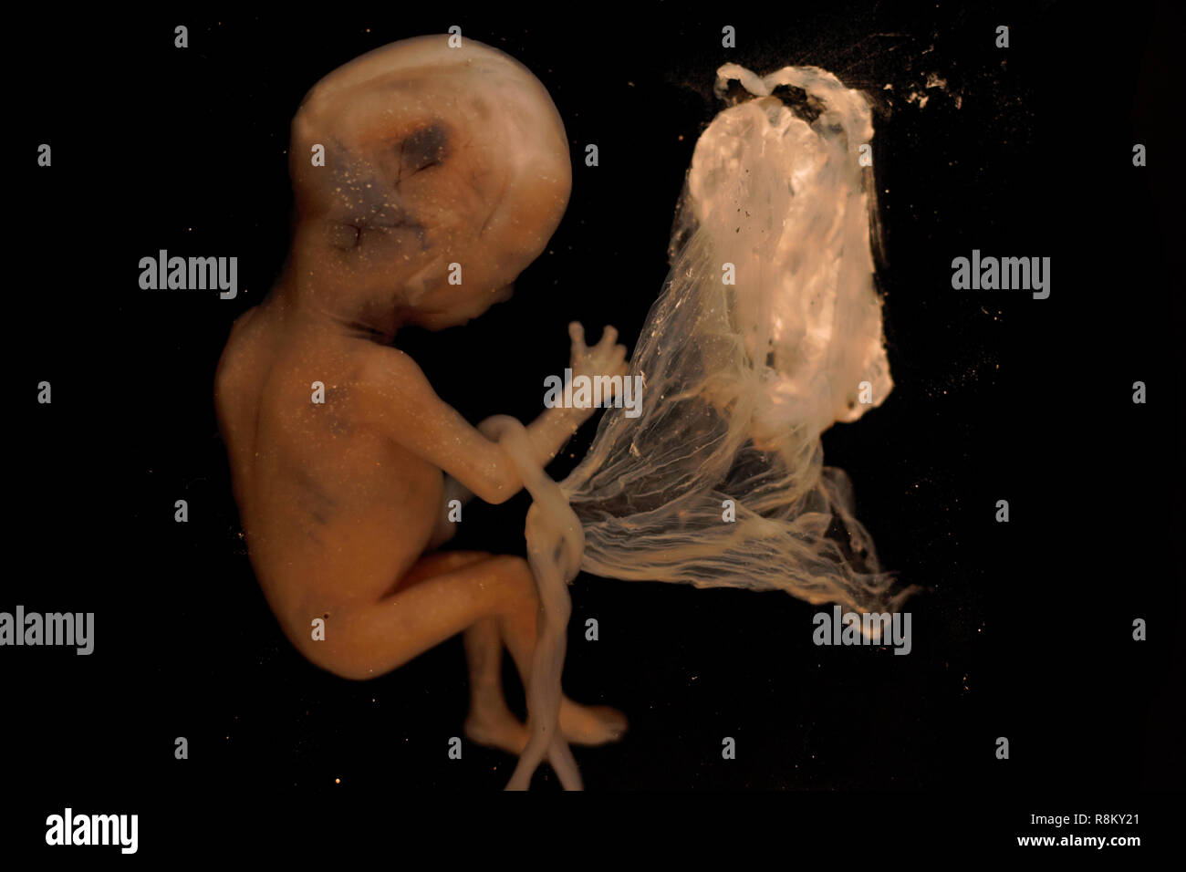 Human fetus at third month of pregnancy. Preserved in Formaldehyde. Stock Photo