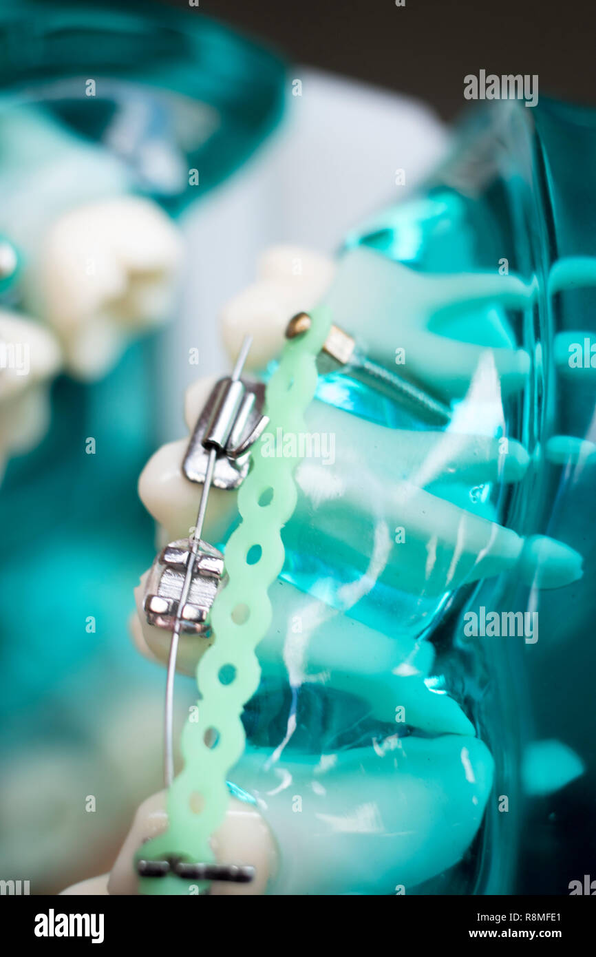 Dental metal braces teeth retainer aligners teaching orthodontics model