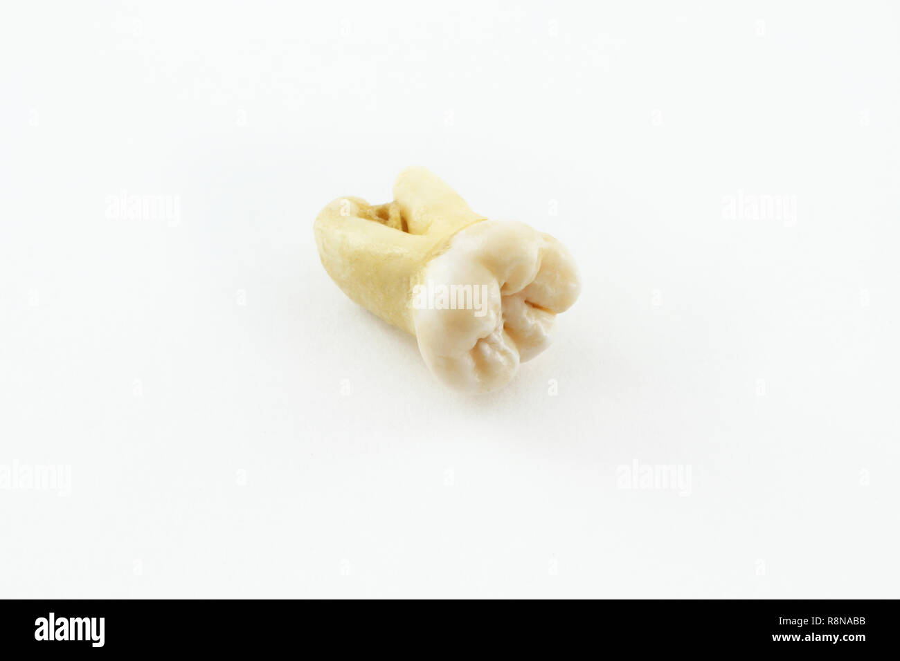 Eighth lower tooth removed together with a piece of bone tissue on paper. Wisdom tooth Stock Photo