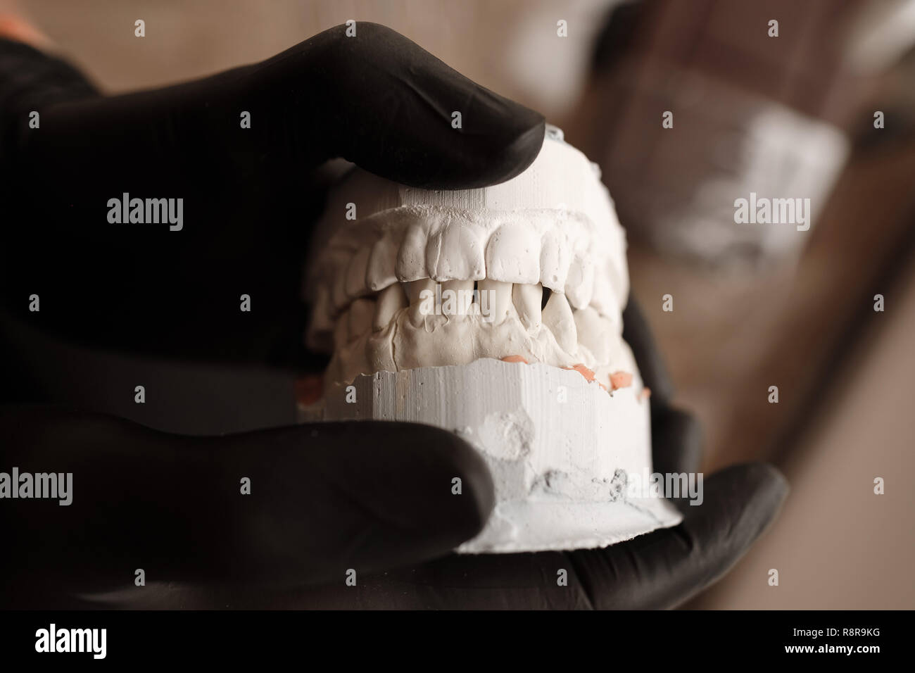 Plaster Cast of jaws. Dentist in black gloves holding Dental casting gypsum model human Jaws in prosthetic laboratory. Dentistry, Orthodontics. Close  Stock Photo