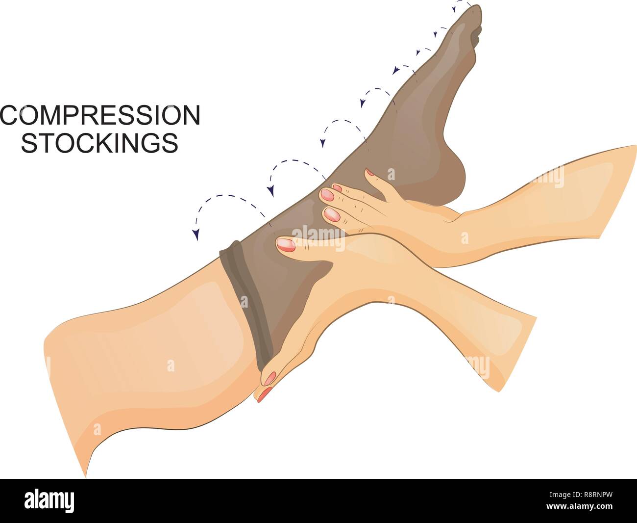 vector illustration of dressing compression stocking on the leg. Stock Vector