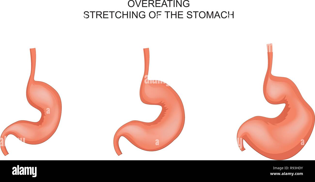 vector illustration of a stomach stretched from overeating Stock Vector