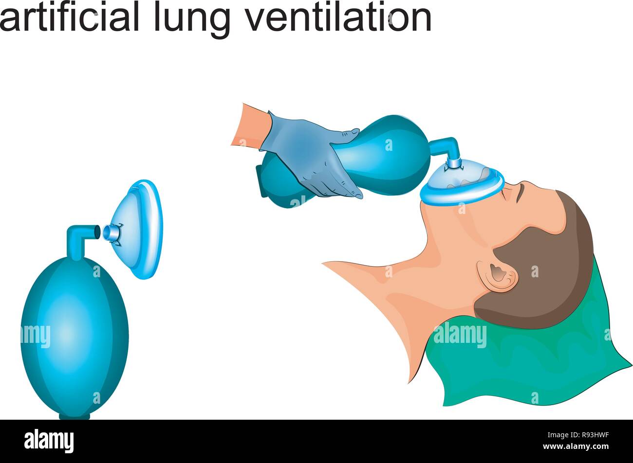 vector illustration of artificial ventilation bag and masks Stock Vector