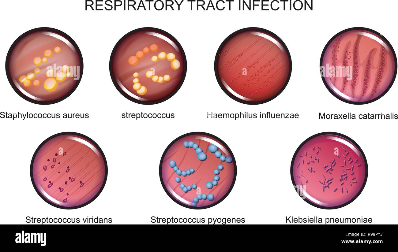 vector illustration of respiratory tract infections. microbiology, bacteriology. Stock Vector