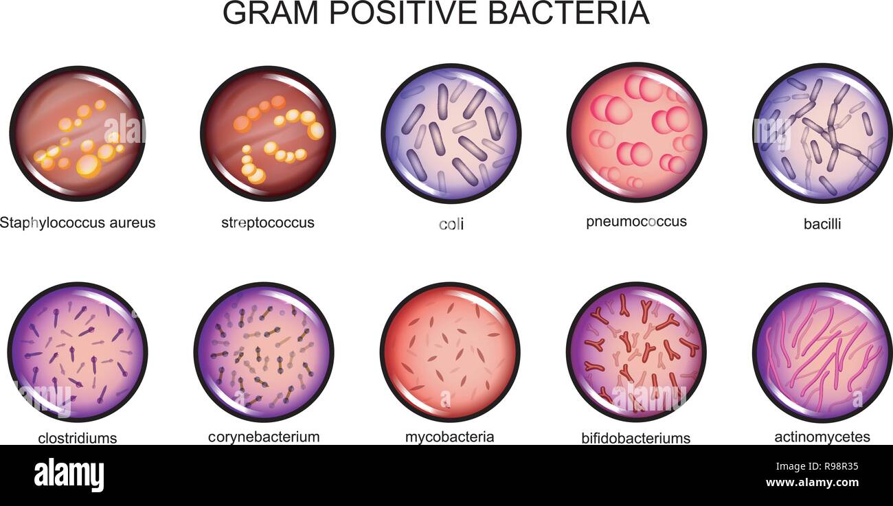 gram negative rods and gram positive cocci